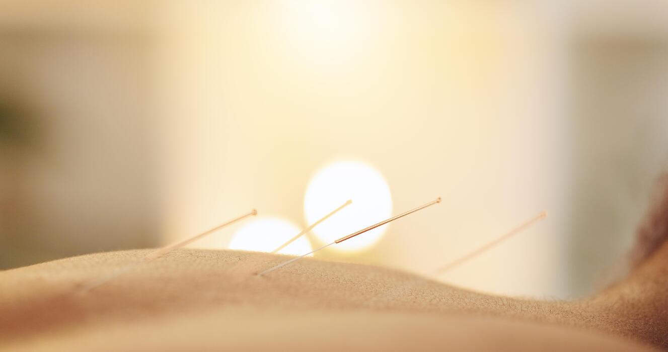 Acupuncture treatment in a clinic supported by managed healthcare IT services