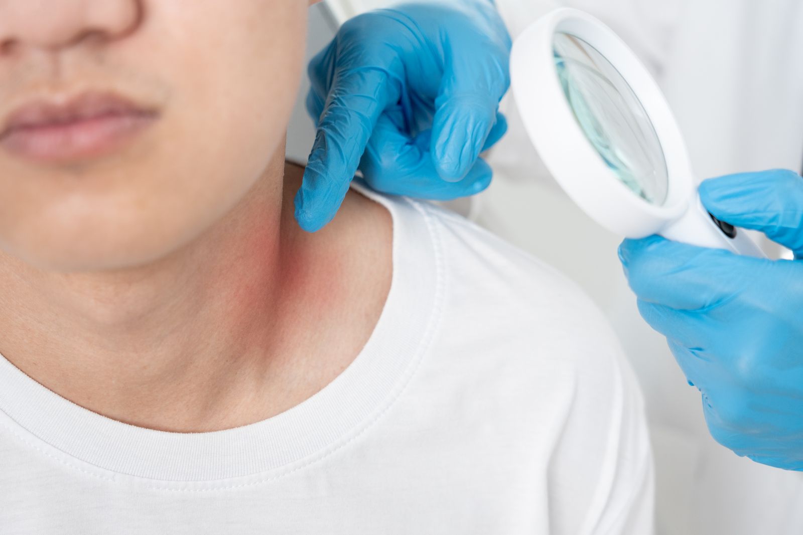 Dermatologist examining patient skin - IT services for dermatology practices