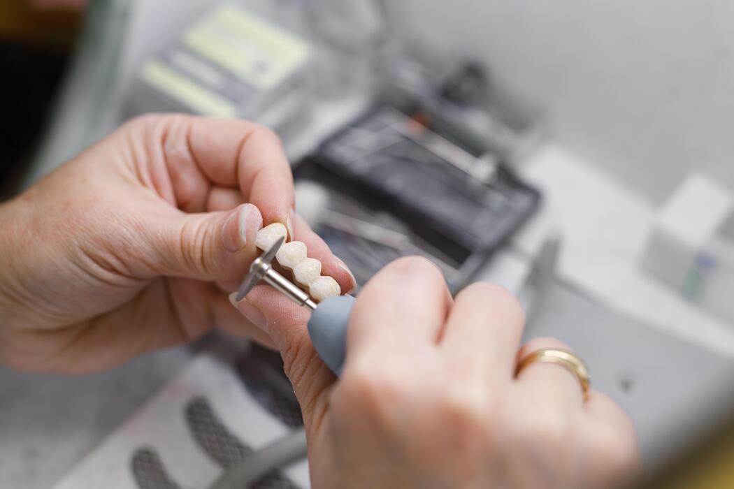 Prosthodontic practices IT support Dental technician fabricating a prosthetic bridge restoration for a prosthodontic practice